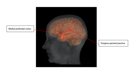 Figure 1. Image depicting the medial prefrontal cortex and temporo-parietal junction.