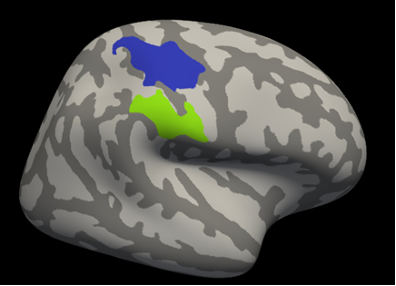 Areas of the brain that have a different structure in underweight people with anorexia nervosa.